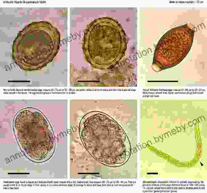 A Photo Of A Microscope Slide With A Specimen Infected With Parasites Practical Microscopy For Beekeepers Don Harris