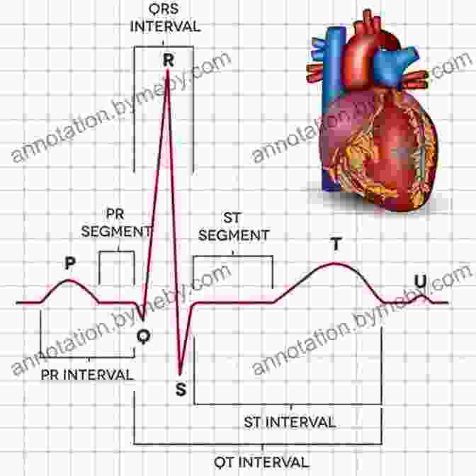 Anatomy Of An EKG EKG/ECG Interpretation: A Complete Step By Step Beginner S Guide To A Rapid Interpretation Of The 12 Lead EKG And On How To Diagnose And Treat Arrhythmias