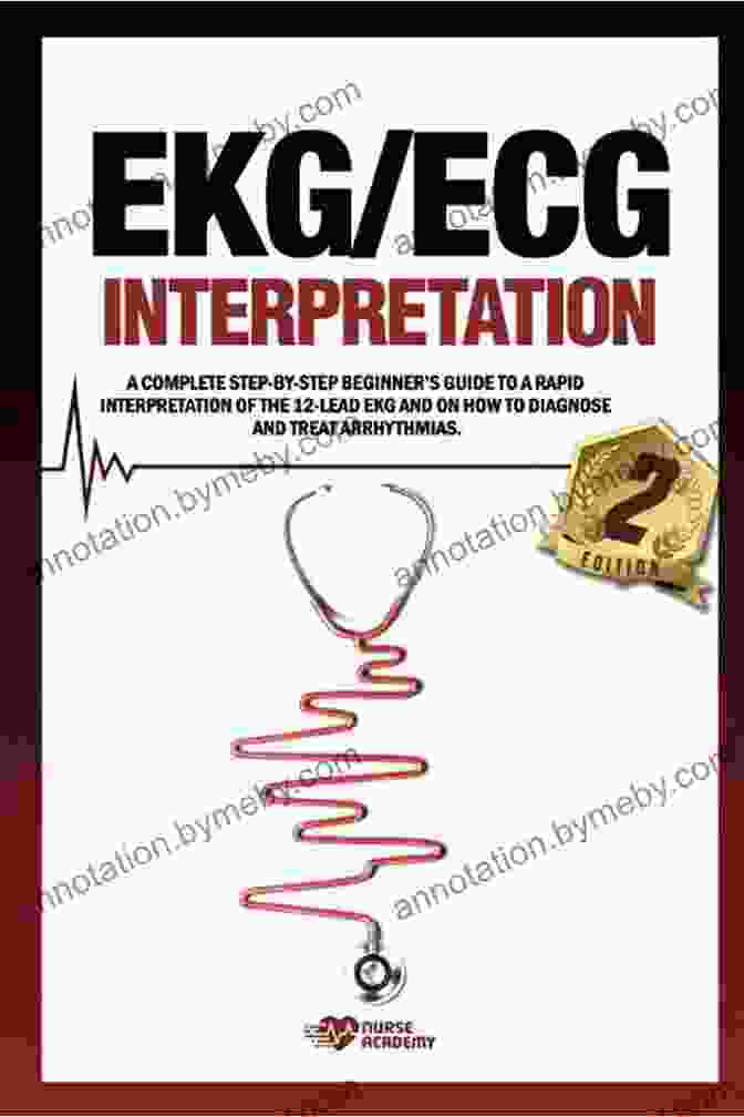 EKG Examples EKG/ECG Interpretation: A Complete Step By Step Beginner S Guide To A Rapid Interpretation Of The 12 Lead EKG And On How To Diagnose And Treat Arrhythmias