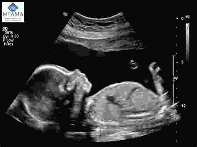 Ultrasound Image Of A Developing Fetus Naturally Conceived: How To Get Pregnant Explain Unexplained Infertility And Prevent Miscarriages By Unleashing Your Reproductive Power Even Over 40